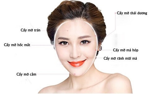 Cây mỡ tự thân là gì?