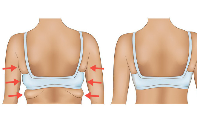 Bài tập giảm mỡ vùng nách hiệu quả
